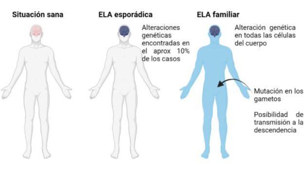 ¿La ELA es hereditaria?